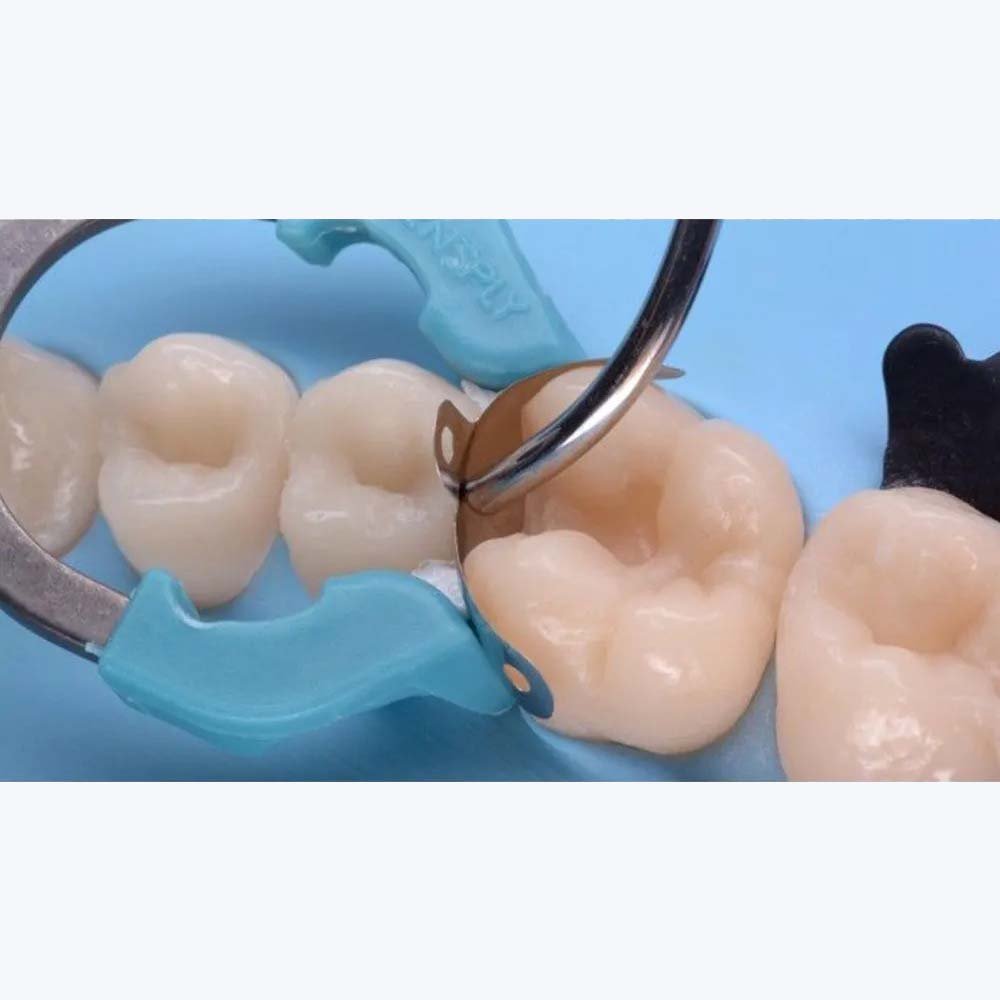 Tor Vm Lug Matrices Set (1.368) - 30 Pcs